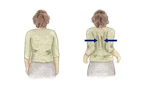 scapular squeeze