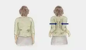 Shoulder-Blade-Squeeze