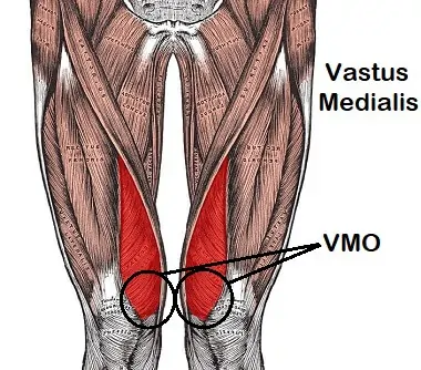 Vastus Medialis Oblique