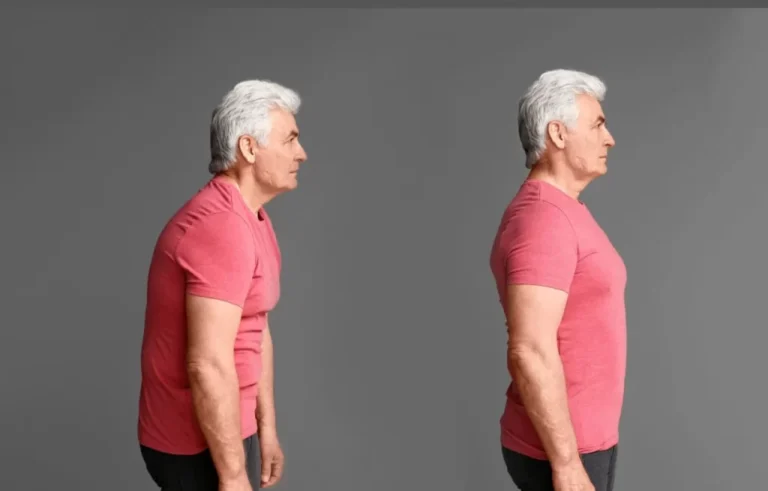 10 Best Exercises For Kyphosis