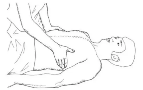 Lateral costal expansion 