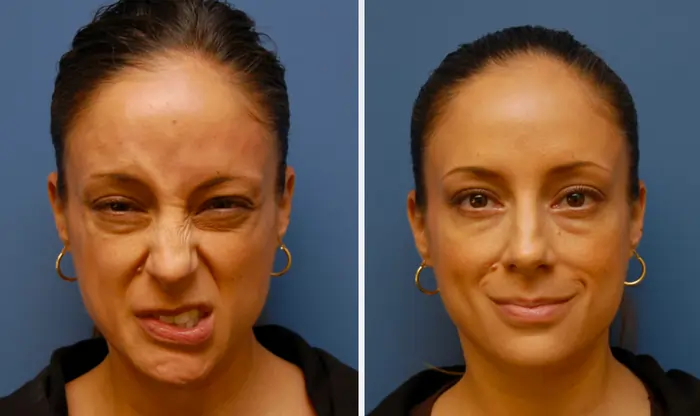 Nose exercise