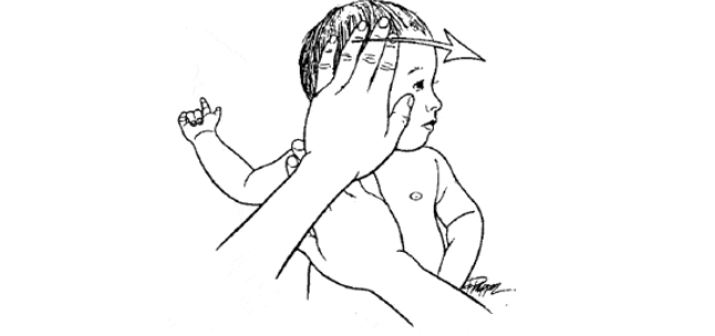 Left Torticollis Exercises