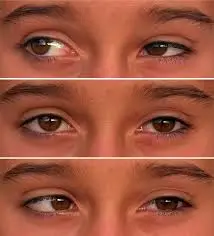 Eye movement