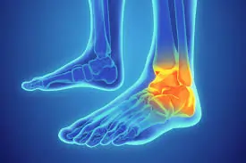 View of Top 10 Ankle Sprain Rehabilitation Exercises You Can Do at Home