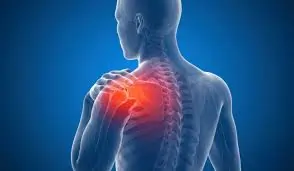 Home Exercises for Frozen Shoulder Relief