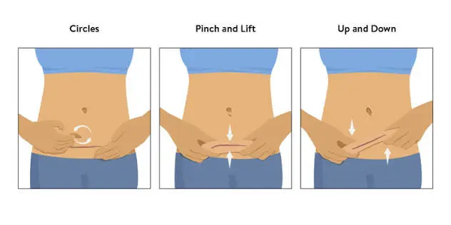Cesarean delivery scar massage